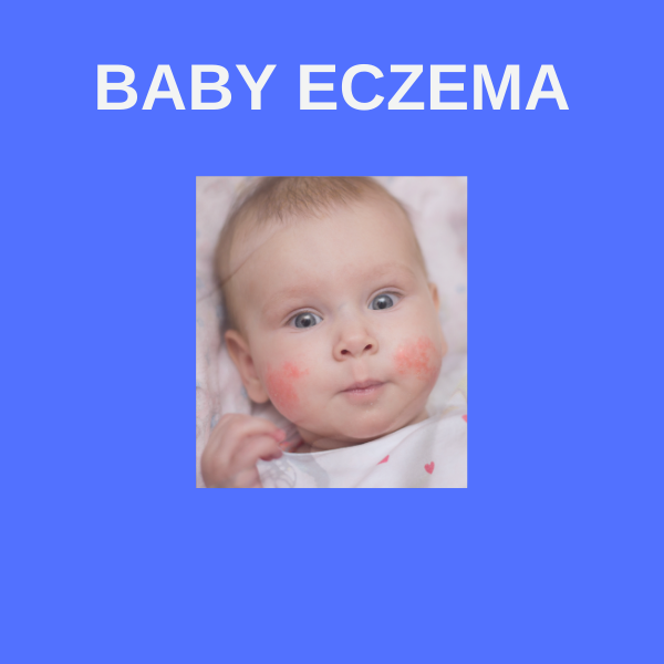Botty Barrier Creme for Eczema Skin Relief (Fragrance Free for Sensitive Skin)