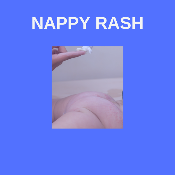 NAPPY RASH